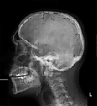 Raggi x, output a video.