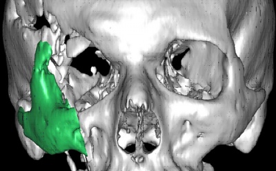 Raggi x del teschio umano